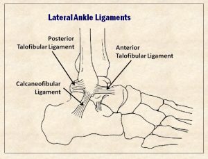 Rory McIlroy’s serious ankle sprain