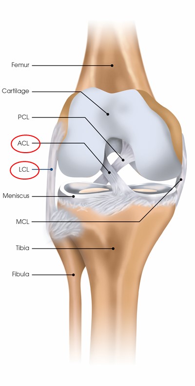 New functional capacity evaluation for ACL injuries definitely tests likeliness for re-injury and readiness to return to sport