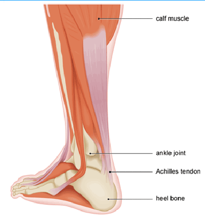 Calf muscle, Achilles tendon strains are preventable