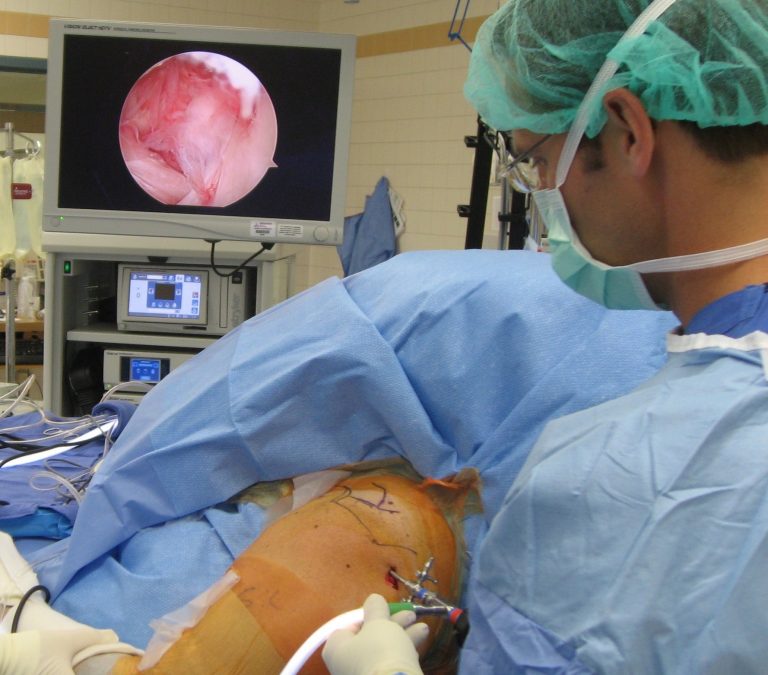 Is it safe to have surgery?